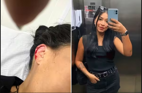 Jovem Sofre Agressão de Morador de Rua a Caminho do Trabalho em Santos